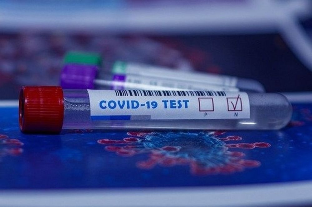1020 заболевших COVID-19 зарегистрировали за сутки на Кубани