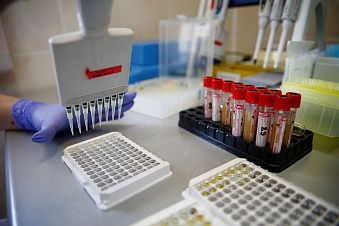 С начала пандемии на Кубани коронавирус подтвердился у 3908 человек С начала пандемии на Кубани коронавирус подтвердился у 3908 человек